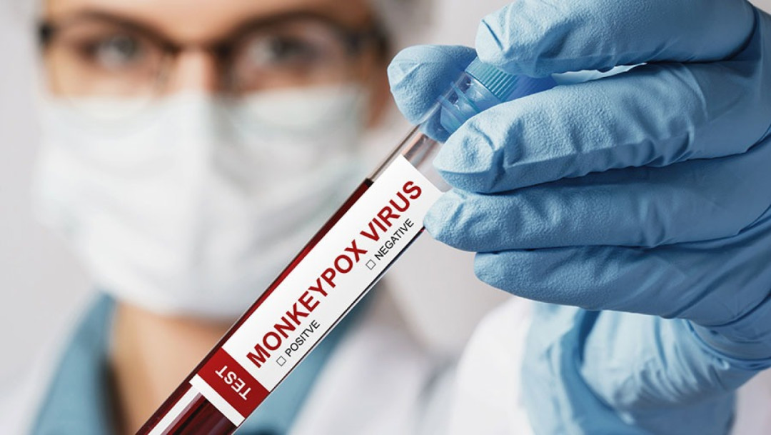 Singapura Catat Dua Kasus Pertama Mpox Penularan Secara Lokal