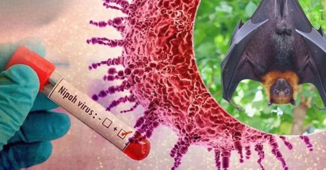 Kemenkes Terbitkan Surat Edaran Kewaspadaan Penyakit Virus Nipah
