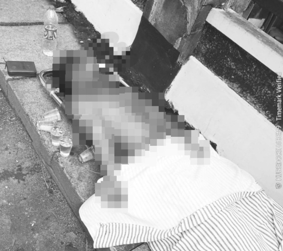 Ledakan SMAN 72 Jakarta, Kapolda Metro: Beberapa Korban Ringan Sudah Dipulangkan