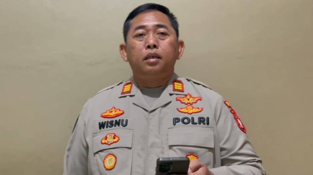 Hasil Pemeriksaan Urine, Onad Terbukti Konsumsi Ganja dan Ekstasi