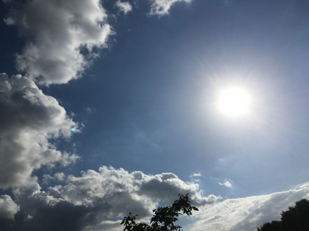 Terpapar Panas Matahari, Begini Cara Aman Membersihkan Wajah