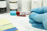 Kasus Hepatitis Akut, IDAI Gorontalo: Ini Gejala dan Pencegahan